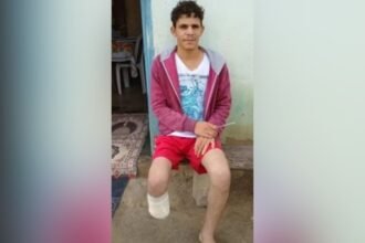 Homem é condenado após amputar o próprio pé para receber indenização de R$ 1,5 milhão de seguradoras